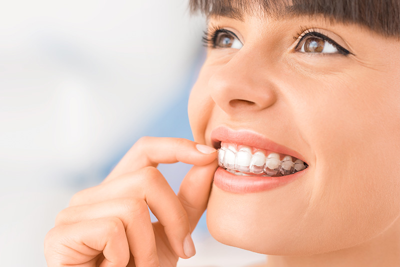 Invisalign in West Jordan