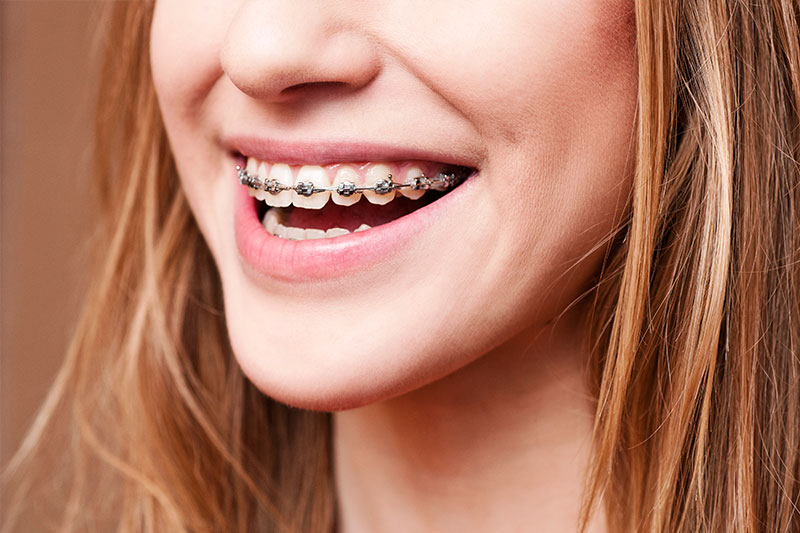 Orthodontics in West Jordan